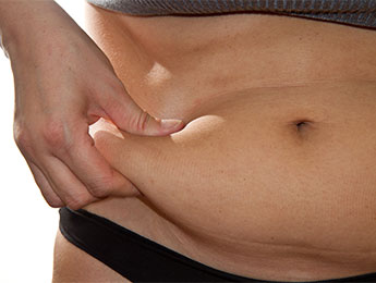 female-abdominoplasty