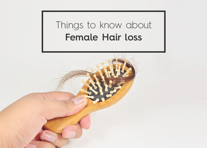 Top-10-Things-to-Know-about-Female-Hair-Loss in Ahmedabad
