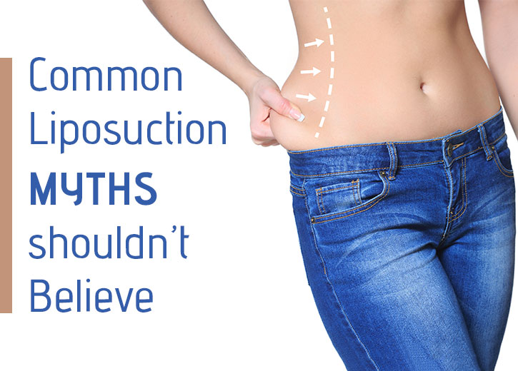 Liposuction myths - Cutis Hospital Ahmedabad